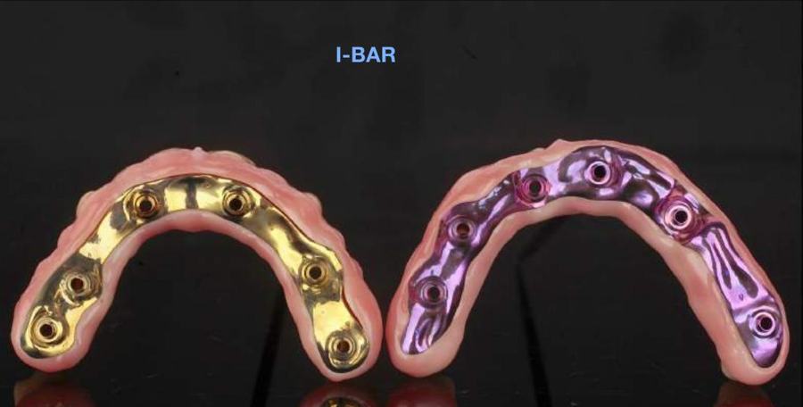 Barre su impianti dorata e viola