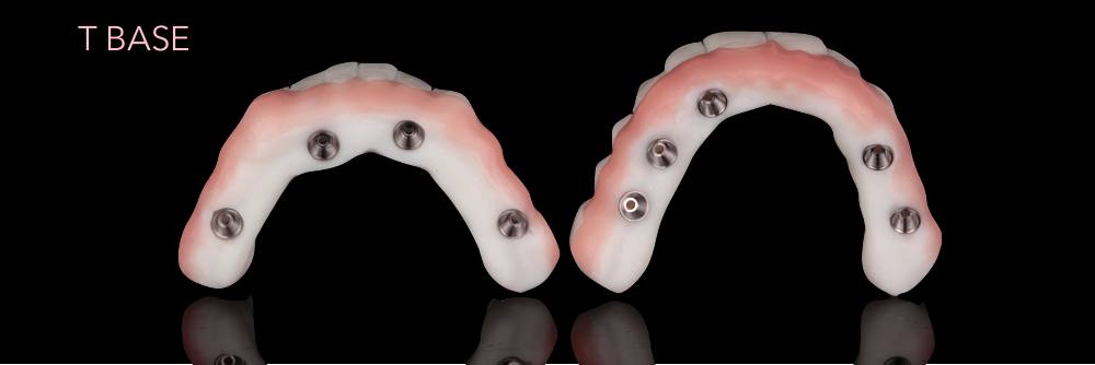Stampa 3D e T-base